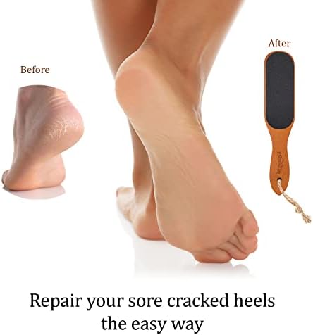Pumice Stone Foot File - Wooden Pedicure Feet Scrubber with Handle for Callus, Dry