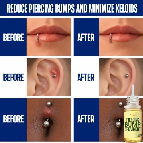 BodyJ4You Piercing Aftercare Spray - Bump Oil Ear Piercing Cleaner Floss