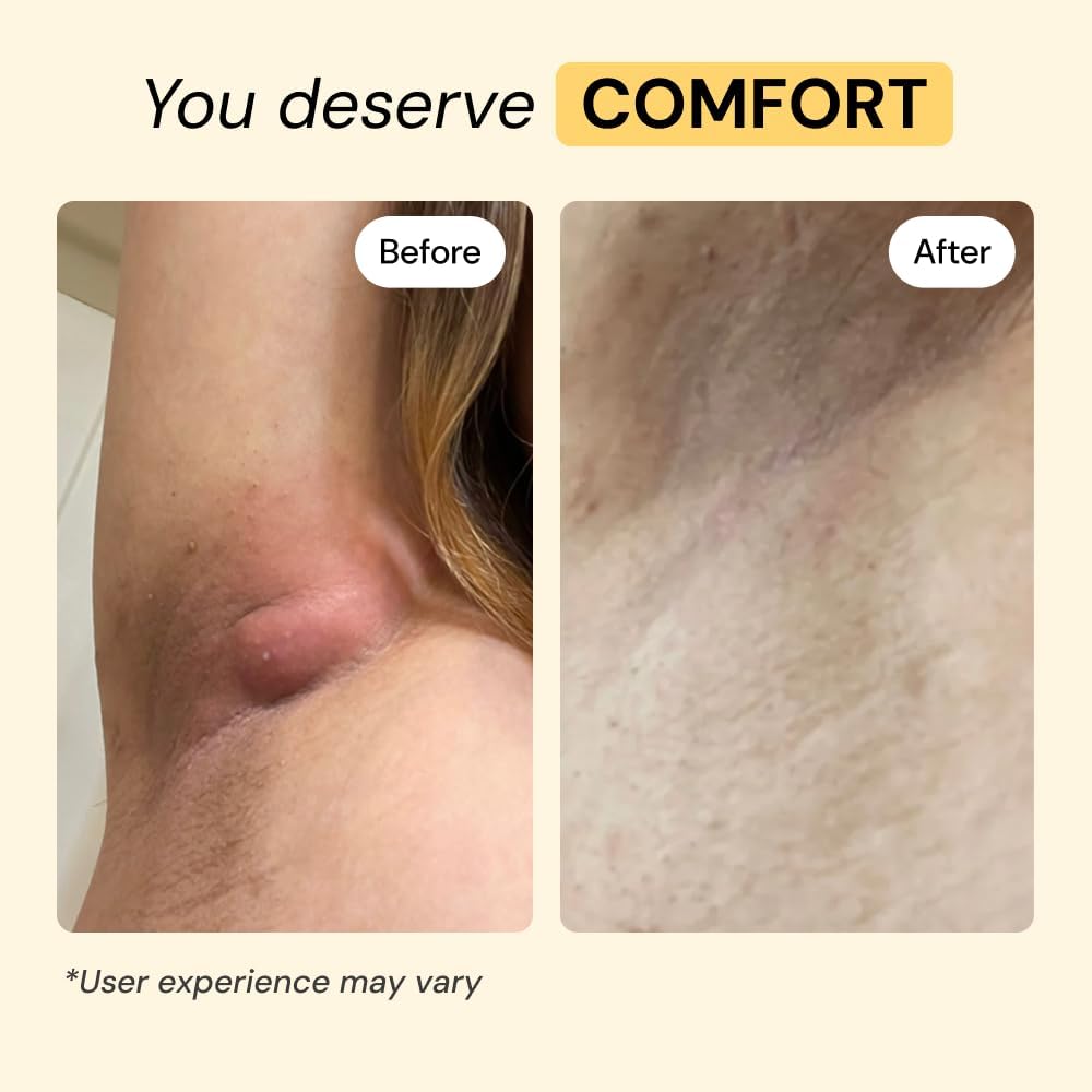 MyMagicHealer Universal Flare Care – Multi-Purpose Solution