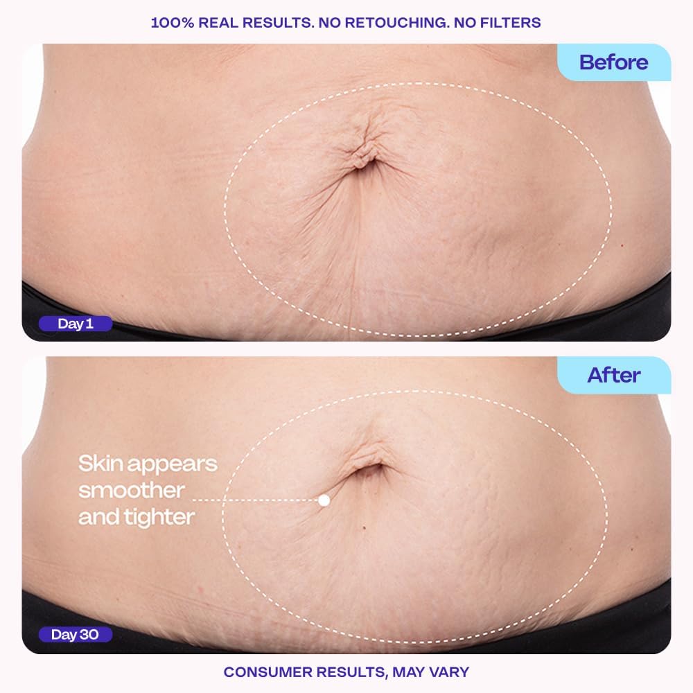goPure Firming Belly Cream - Dermatologist-Developed Moisturizer with