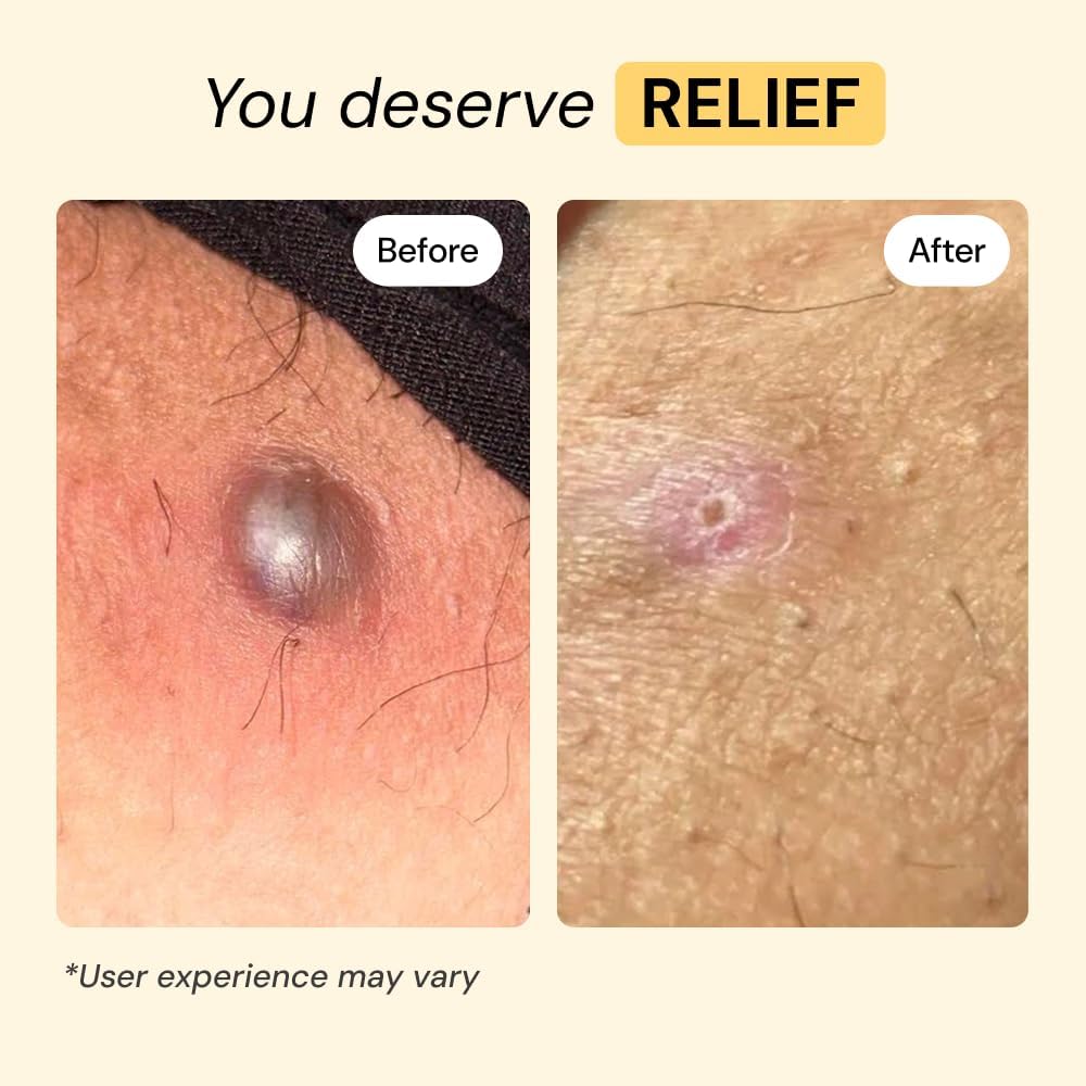 MyMagicHealer Universal Flare Care – Multi-Purpose Solution