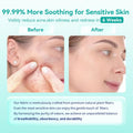 Face Towels, 10"×12" Disposable Face Towel, Face Towelettes XL, Ultra Soft