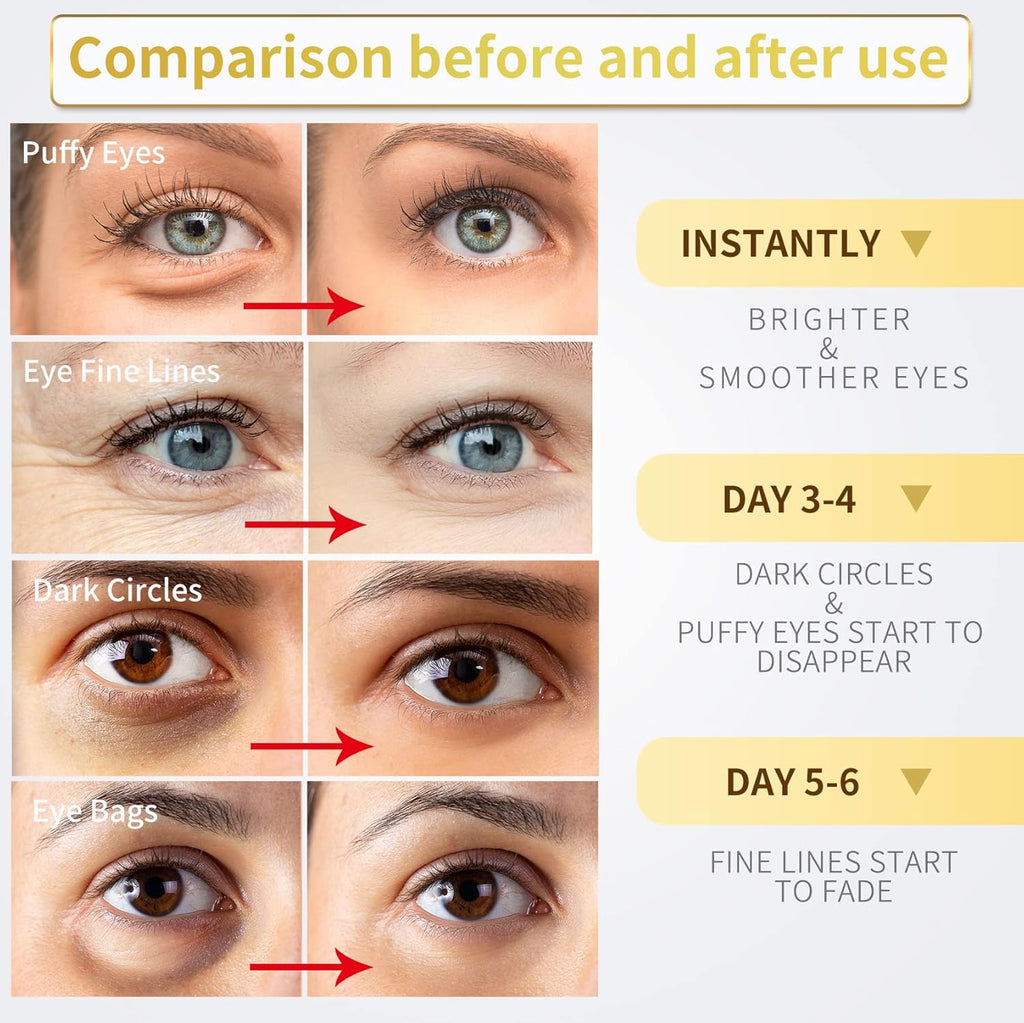 NAZANO 24K Gold Under Eye Patches - 60 Pack for Puffy Eyes, Dark Circles