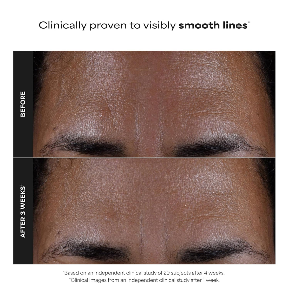 Paula's Choice SKIN PERFECTING 2% BHA Liquid Exfoliant with Salicylic Acid